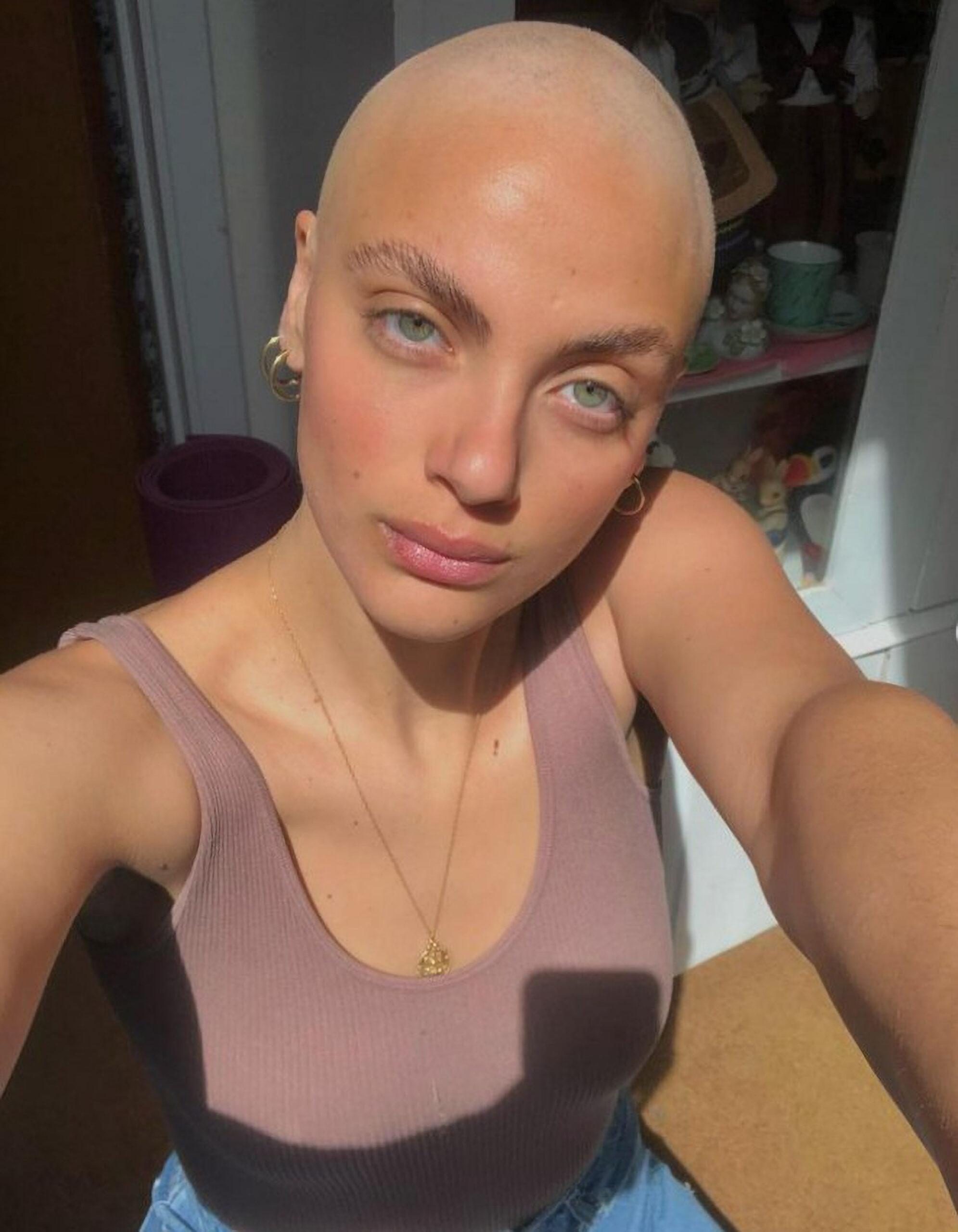 BALD IS BEAUTIFUL: Model Shaves Head After…
