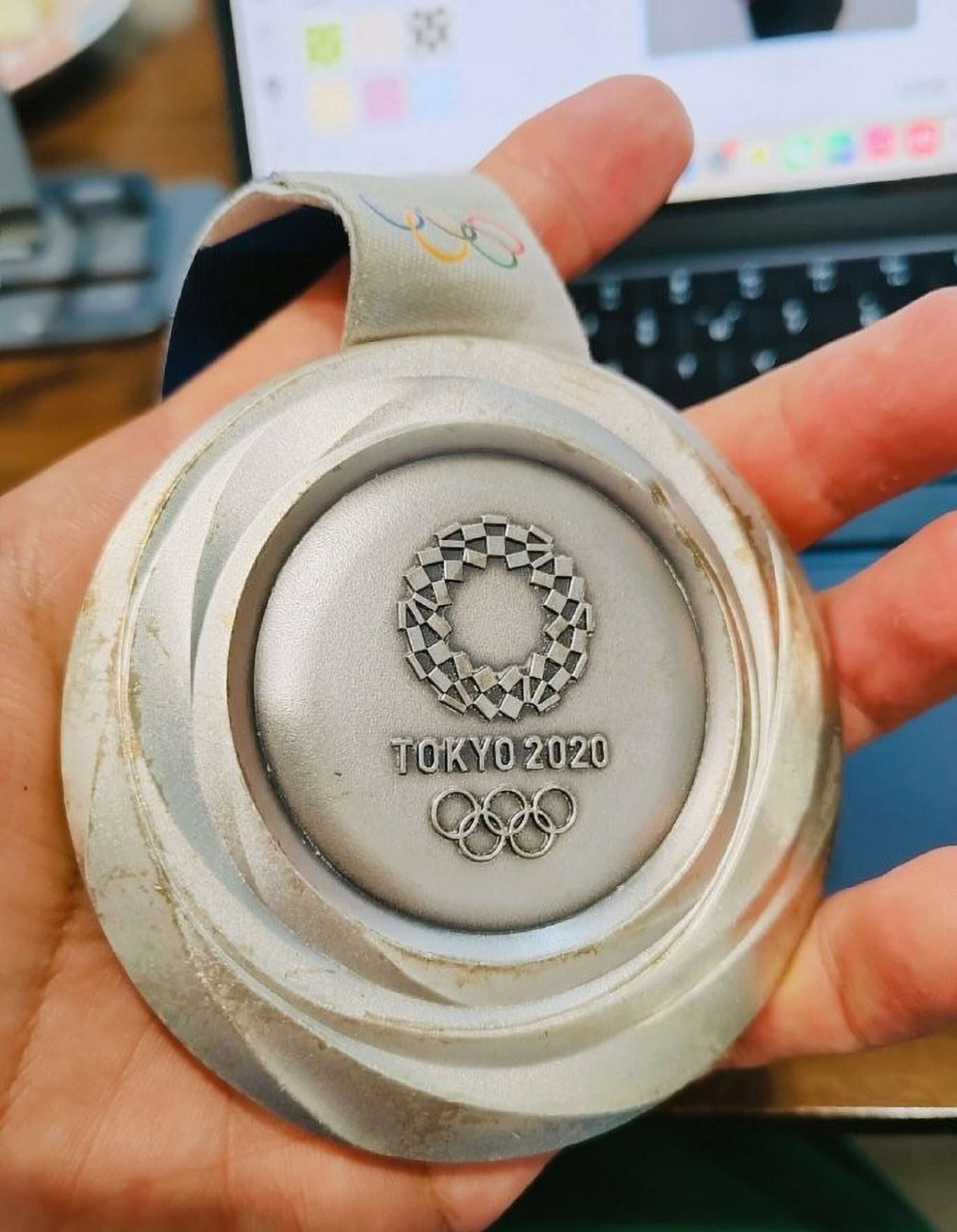 Read more about the article Olympic Athlete Shows Shocking Deterioration Of Olympic Medal Made From Old Phones