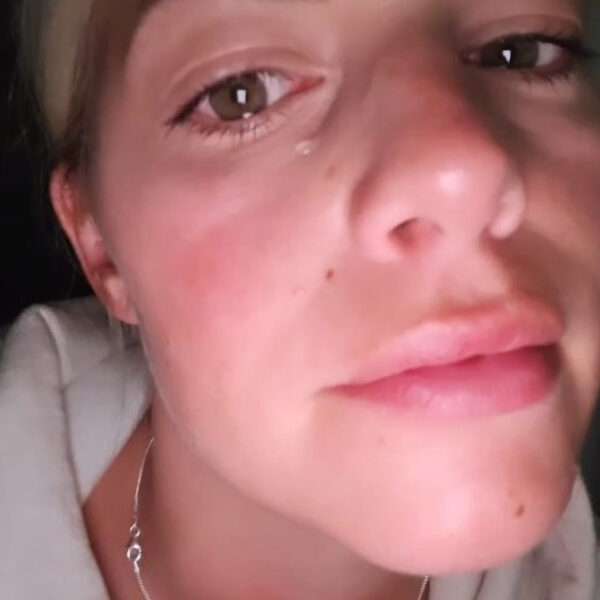 Model Can’t Help Shedding Tears In Weird Side Effect Of Her Facial…