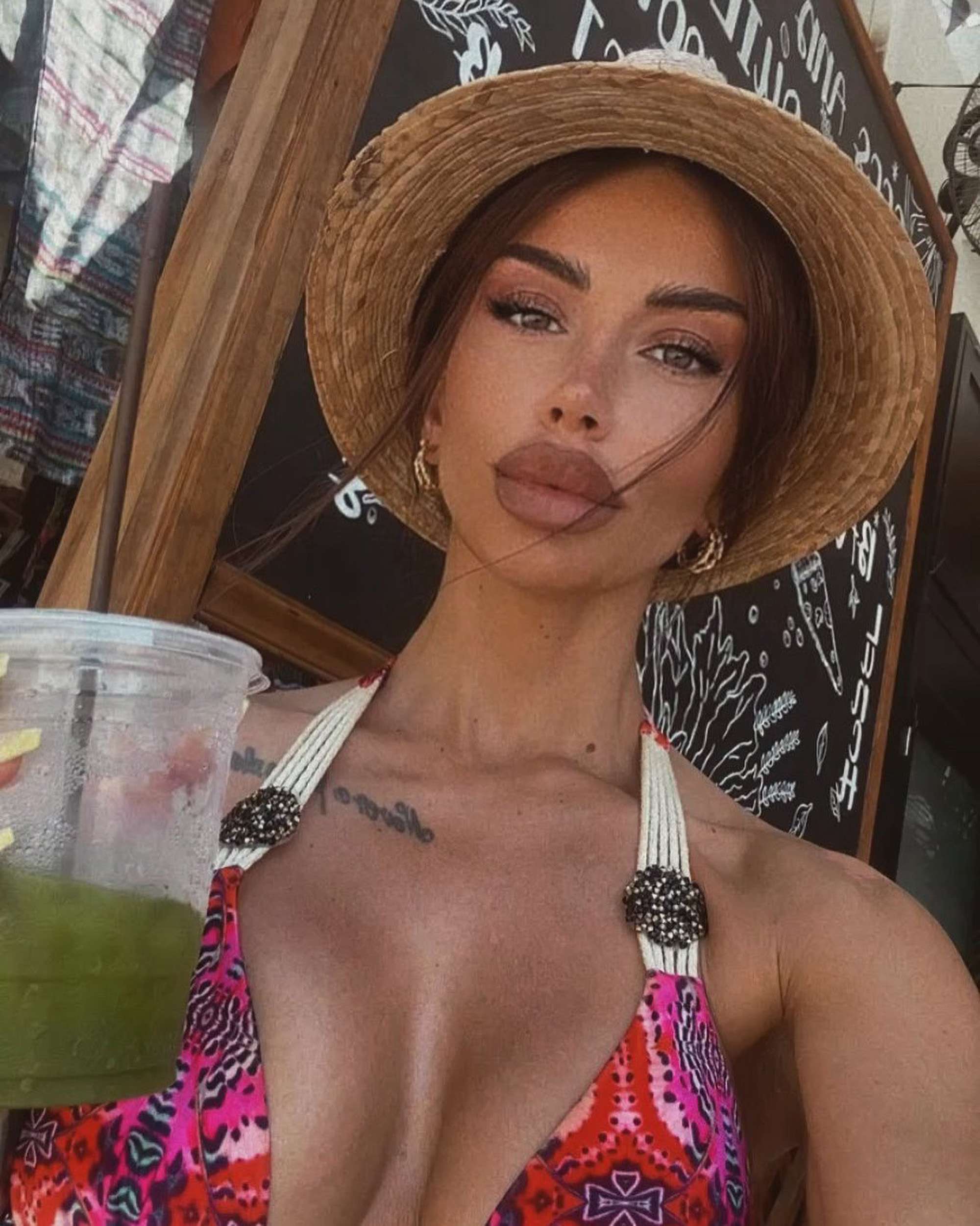 Read more about the article Gorgeous Influencer Says The Seatbelt Saved Her Life After Her Vehicle Overturned During Night Out In Greece